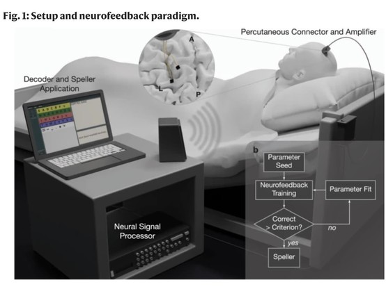 Setup and neurofeedback paradigm