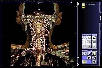 Siemens Health Software medical scan inside human head