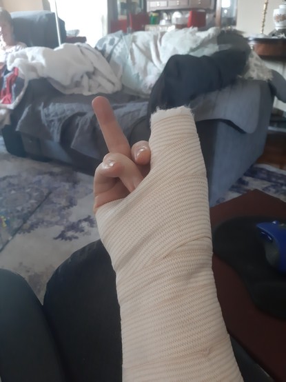 Crushed thumb in a cast and wrap.
