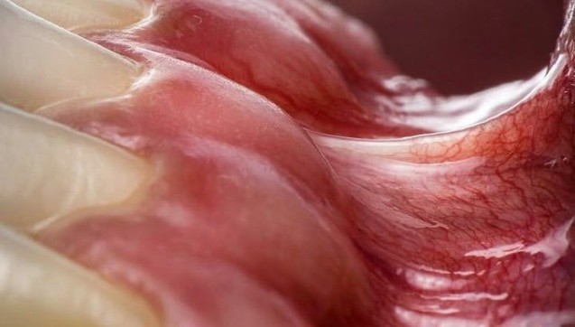 inside of persons mouth teeth gums