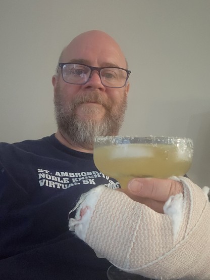 Me holding a marg in my broken hand